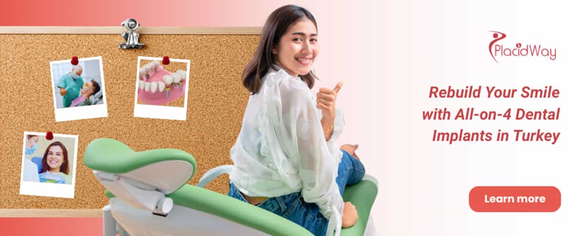 All on 4 Dental Implants in Turkey