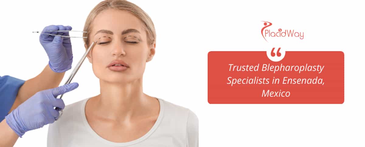 Blefaroplastia en Ensenada, México