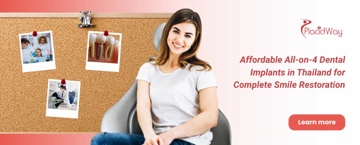 All on 4 Dental Implants in Thailand
