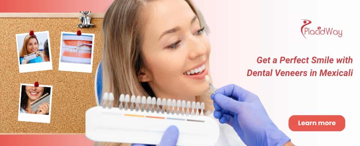 Dental Veneers in Mexicali