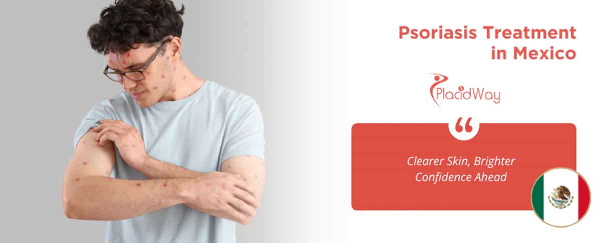 Tratamiento de la psoriasis en México