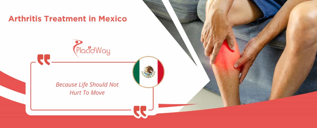 Tratamiento de la artritis en México