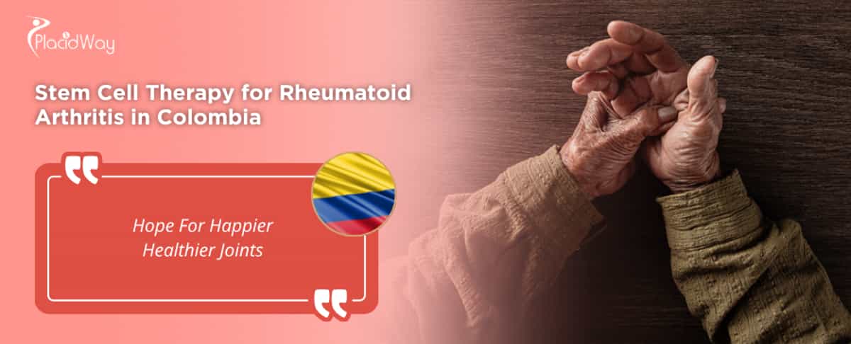 Terapia con células madre para la artritis reumatoide en Colombia