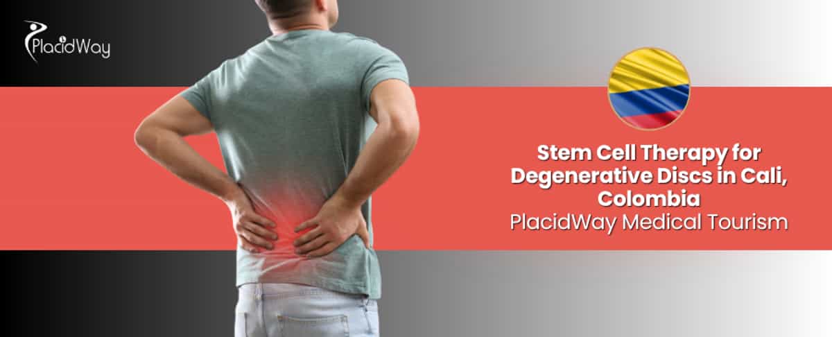 Stem Cell Therapy for Degenerative Disc in Cali, Colombia 