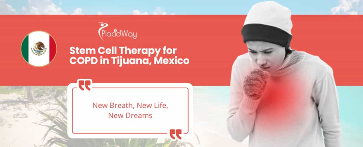 Terapia con células madre para la EPOC en Tijuana, México