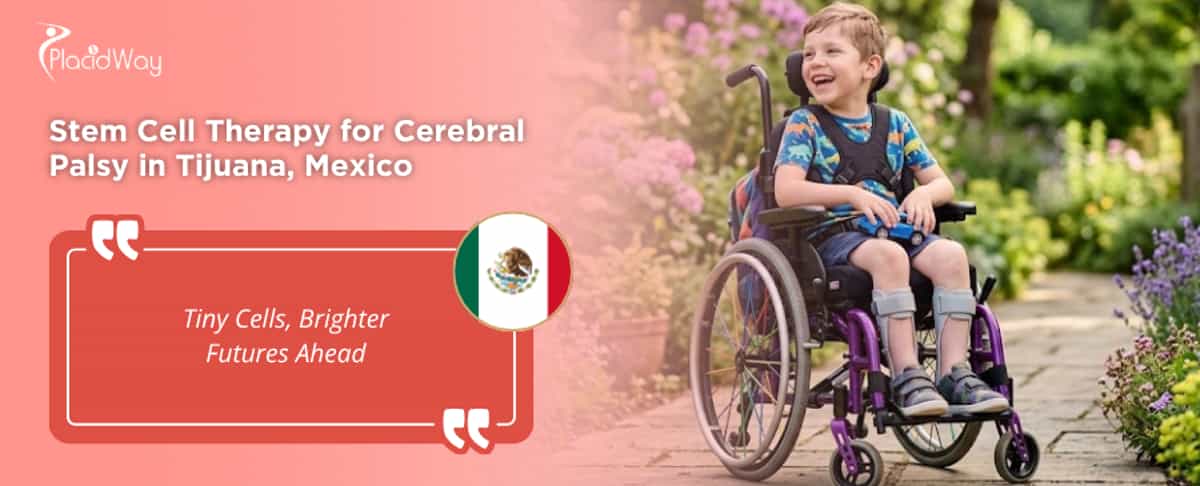Terapia con células madre para parálisis cerebral en Tijuana, México