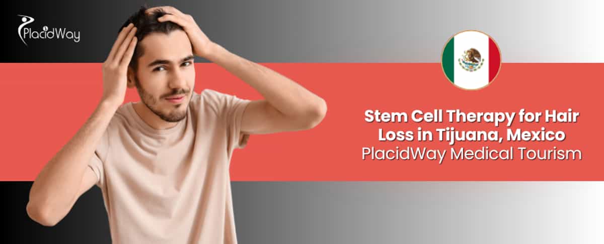 Stem Cell Therapy for Hair Loss in Tijuana, Mexico