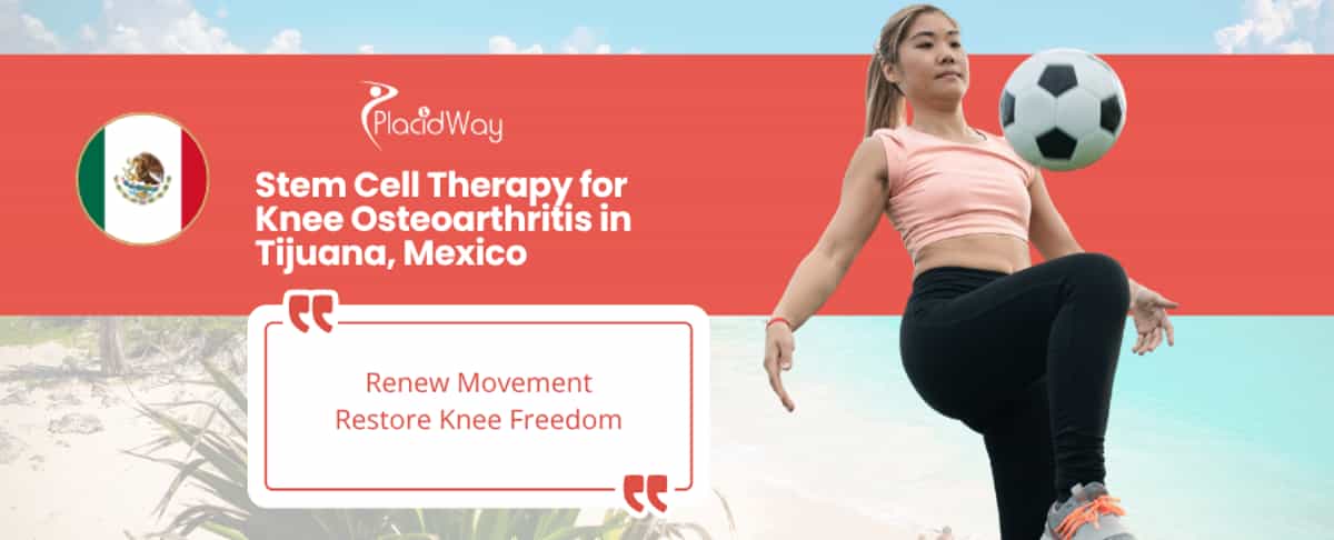 Stem Cell Therapy for Knee Osteoarthritis in Tijuana, Mexico