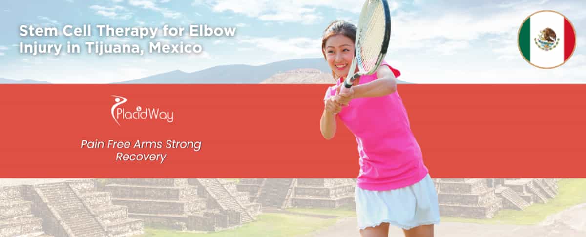 Stem Cell Therapy for Elbow Injury in Tijuana, Mexico