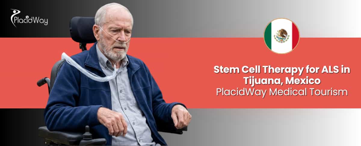 Stem Cell Therapy for ALS in Tijuana, Mexico