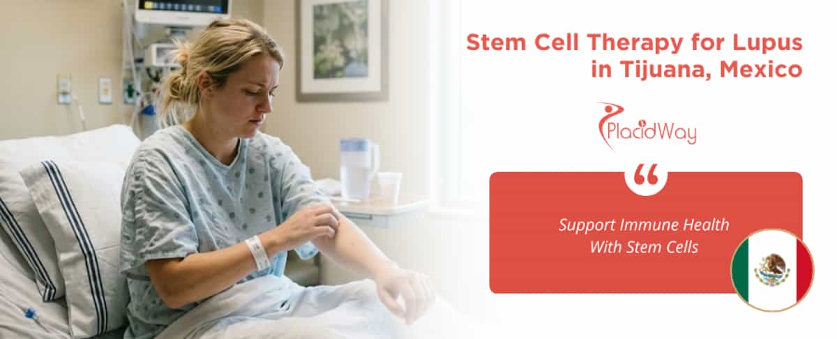 Stem Cell Therapy for Lupus in Tijuana, Mexico