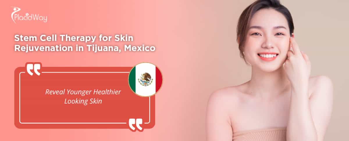 Stem Cell Therapy for Skin Rejuvenation in Tijuana, Mexico