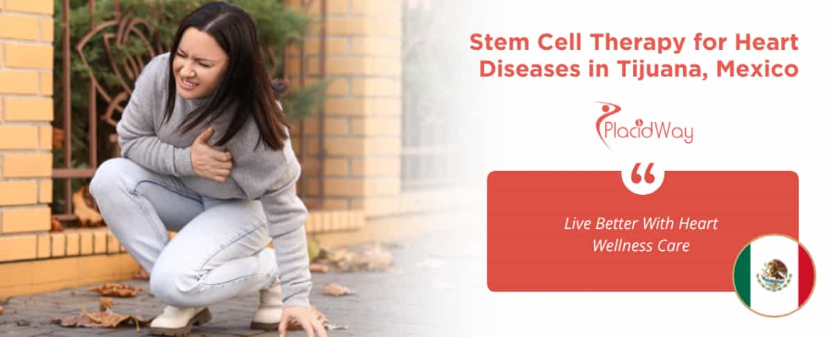 Stem Cell Therapy for Heart Diseases in Tijuana, Mexico