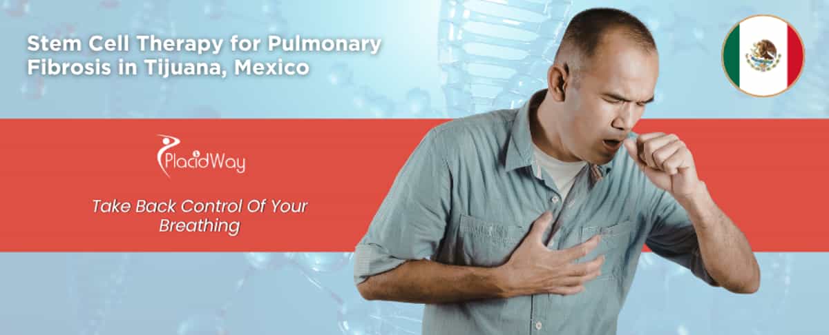Stem Cell Therapy for Pulmonary Fibrosis in Tijuana, Mexico