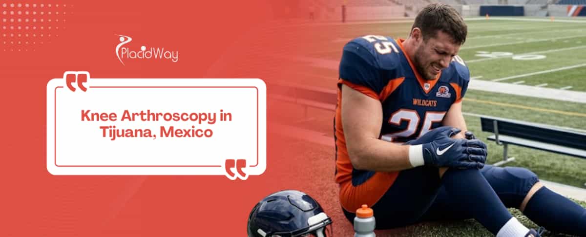 Knee Arthroscopy in Tijuana, Mexico
