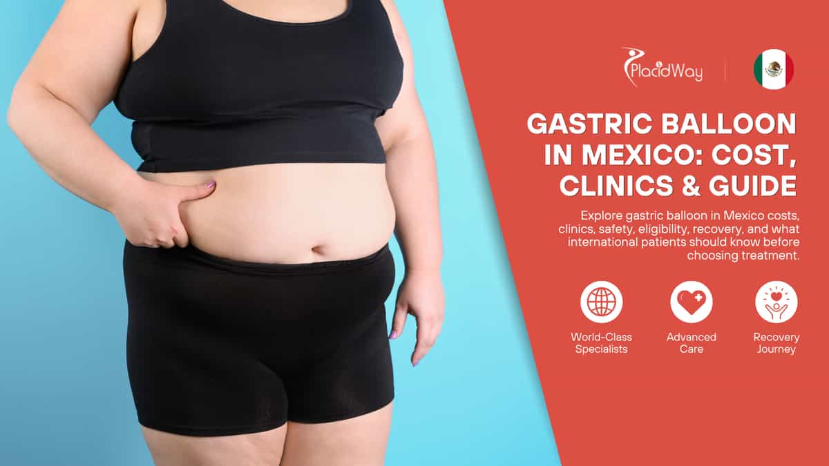 Gastric Balloon in Mexico