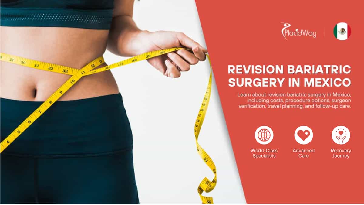 Cirugía Bariátrica de Revisión en México 
