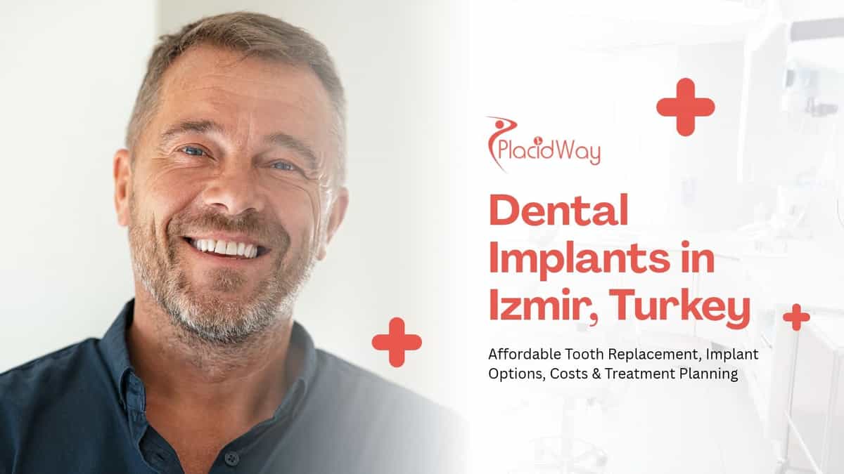 Implantes dentales en Izmir, Turquía: tu salud bucal asequible