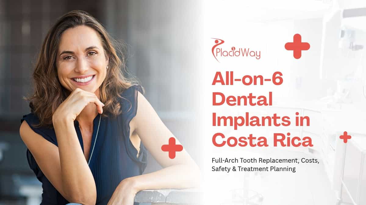 Implantes dentales All on 6 en Costa Rica