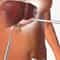 Laparoscopic Gallbladder Removal Surgery Package in Cancun, Mexico by Costamed