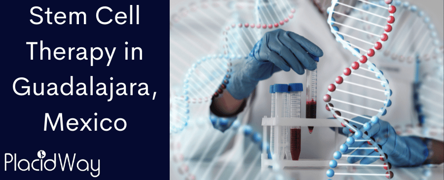 Terapia con células madre en Guadalajara, México: asequible y eficaz thumbnail