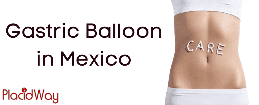 Gastric Balloon in Mexico thumbnail