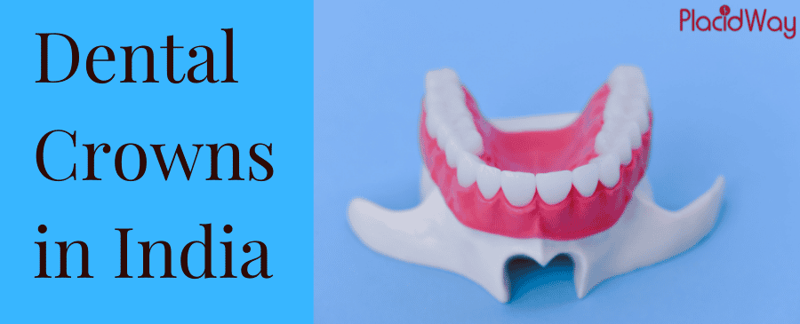 Dental Crowns in India - Quality Dental Work thumbnail