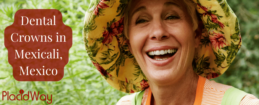 Coronas dentales en Mexicali: las mejores clínicas dentales y dentistas thumbnail