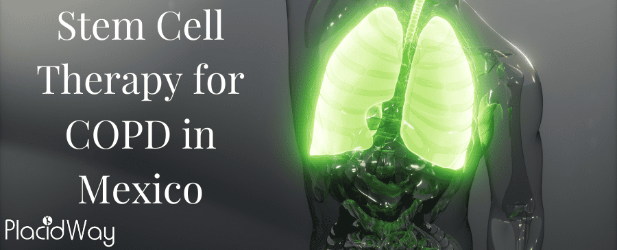 Unveiling the Potential of COPD Stem Cell Therapy in Mexico