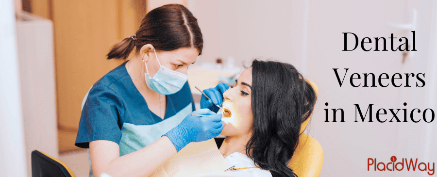 Carillas dentales en México thumbnail