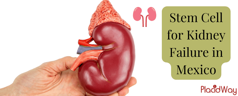 Stem Cell for Kidney Failure in Mexico thumbnail
