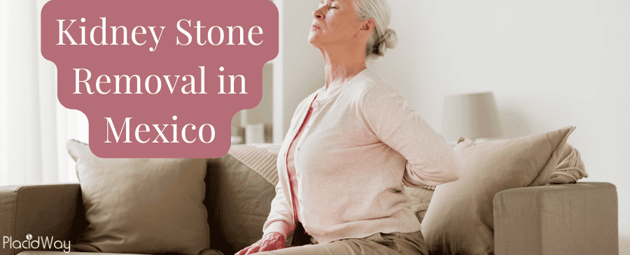 Cirugía para eliminar cálculos renales en México thumbnail