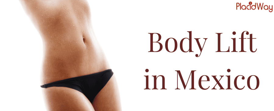 Body Lift in Mexico thumbnail