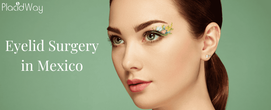 Eyelid Surgery in Mexico thumbnail