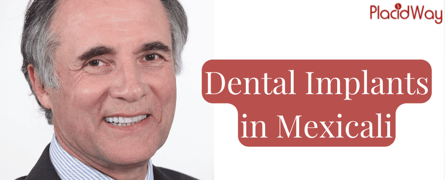 Dental Implants in Mexicali, Package, Cost, Clinics, Reviews thumbnail