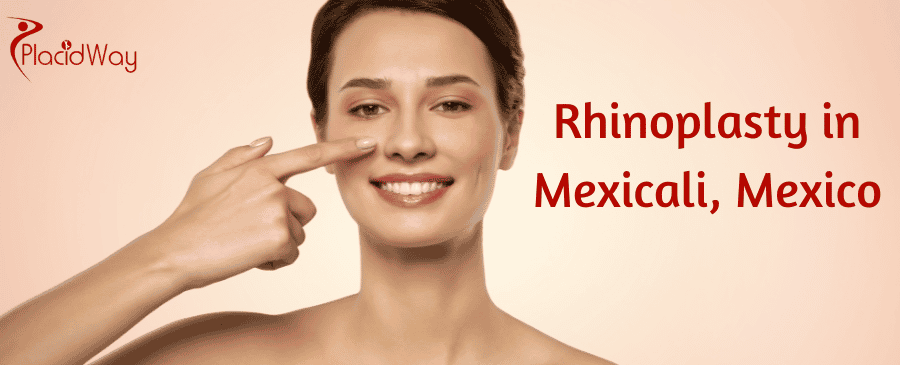 Rhinoplasty in Mexicali, Mexico thumbnail
