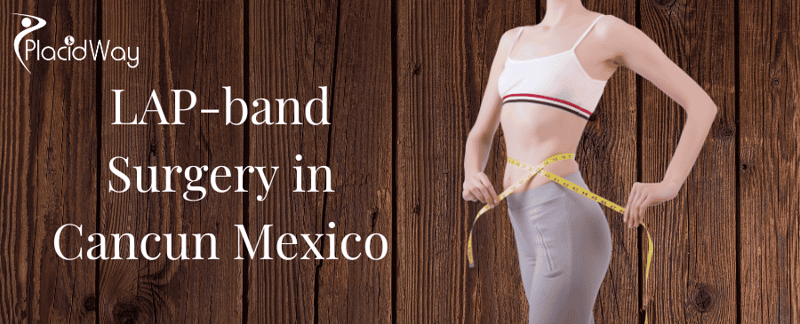 LAP-band Surgery in Cancun Mexico thumbnail