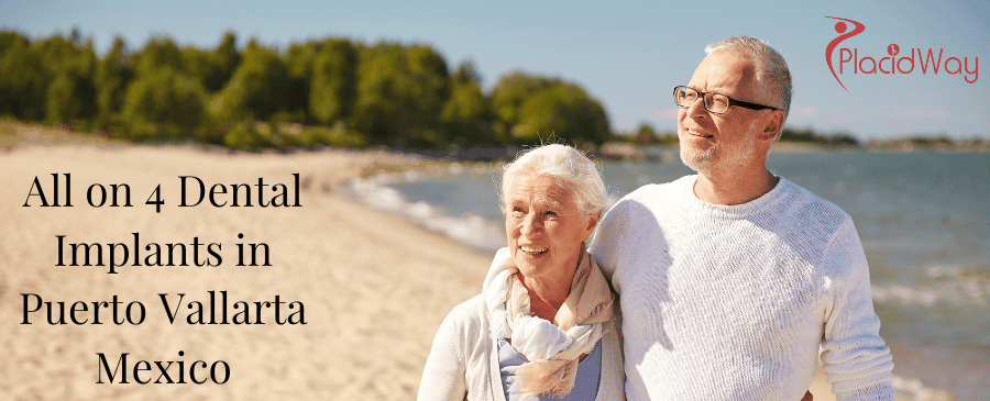 Implantes dentales All on 4 en Puerto Vallarta México thumbnail