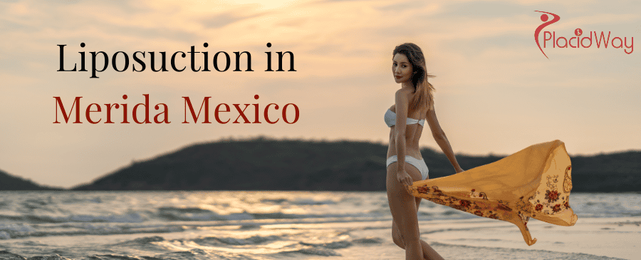 Liposuction in Merida, Mexico thumbnail