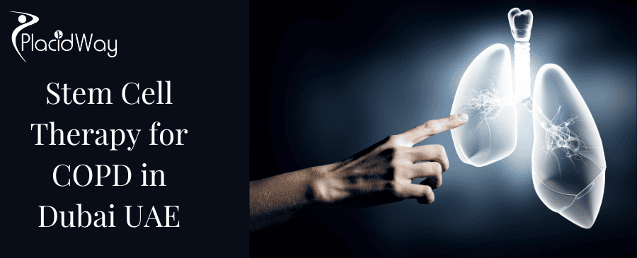 علاج مرض الانسداد الرئوي المزمن بالخلايا الجذعية في دبي، الإمارات العربية المتحدة thumbnail