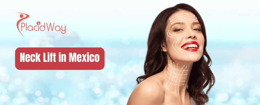 Lifting de cuello en México thumbnail