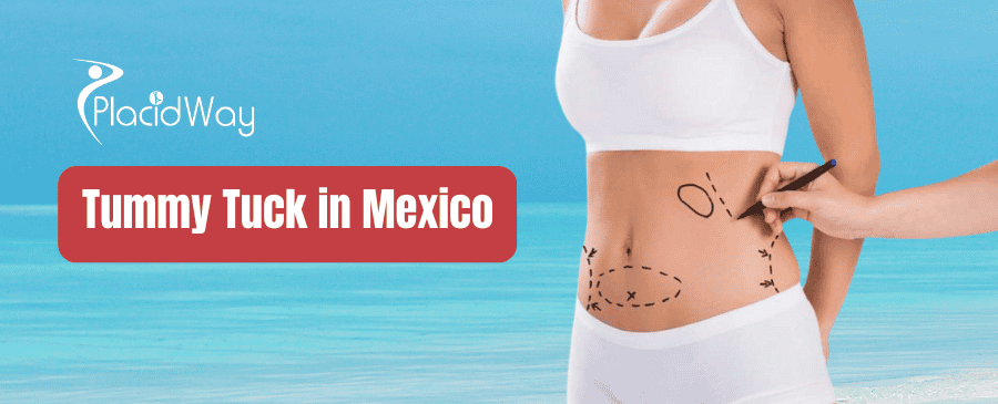 Abdominoplastia en México thumbnail