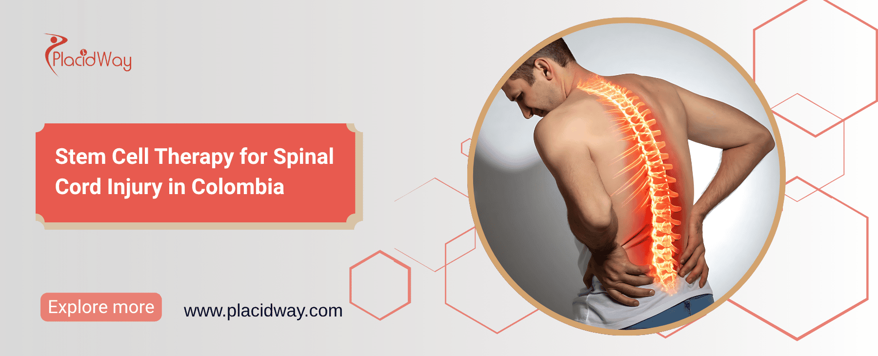 Terapia con células madre para la lesión medular en Colombia thumbnail