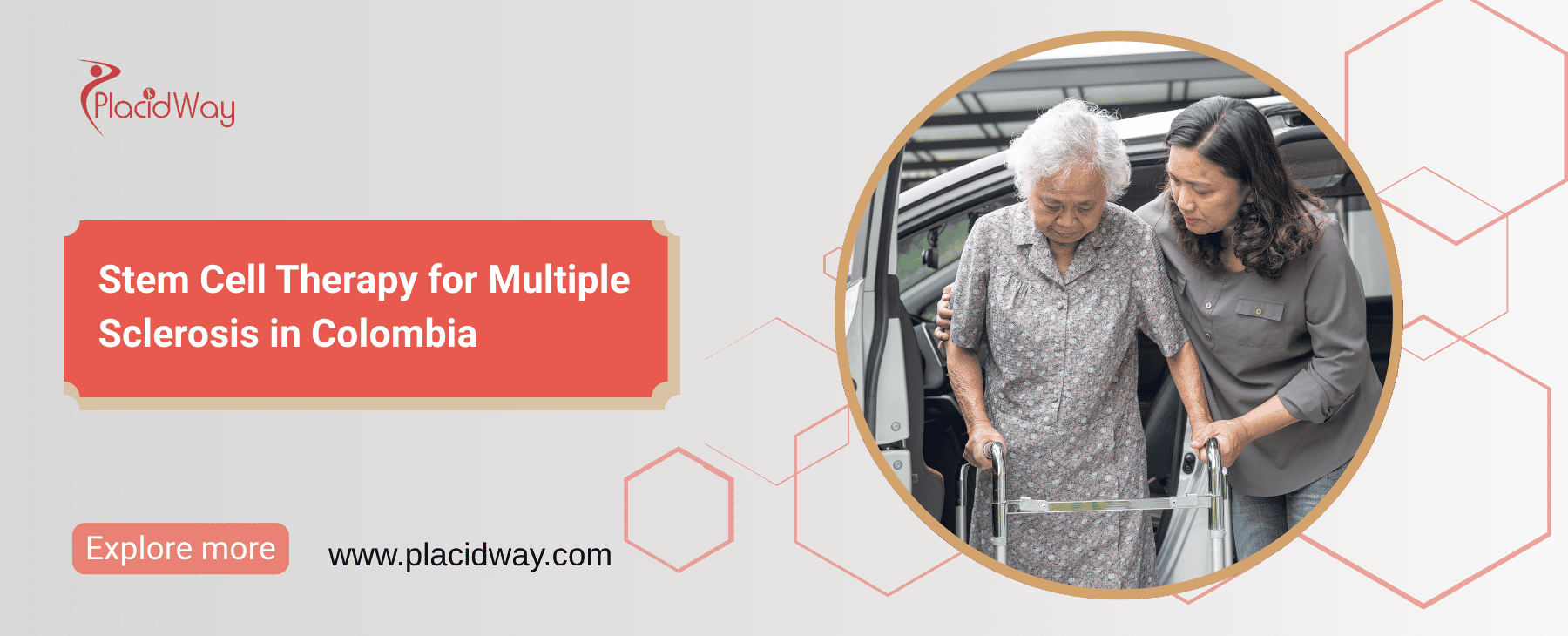 Terapia con células madre para la esclerosis múltiple en Colombia thumbnail