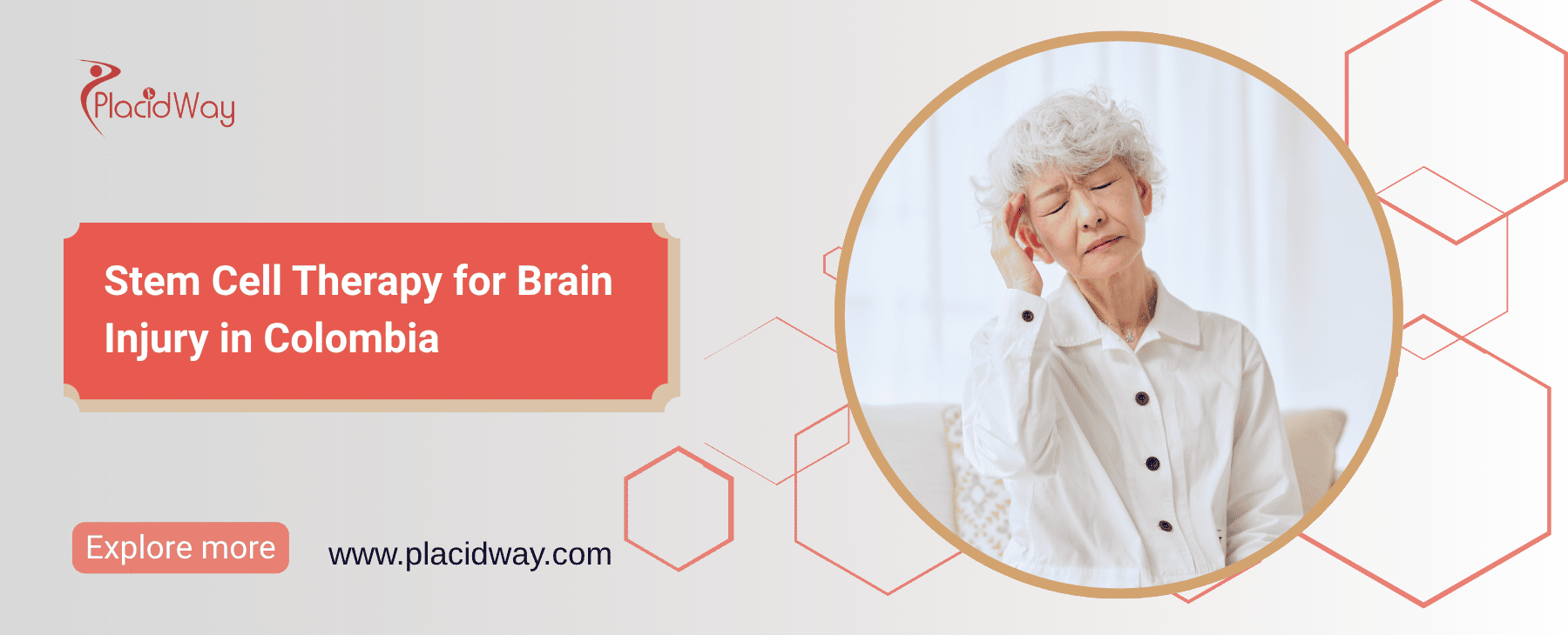 Terapia con células madre para la lesión cerebral en Colombia thumbnail