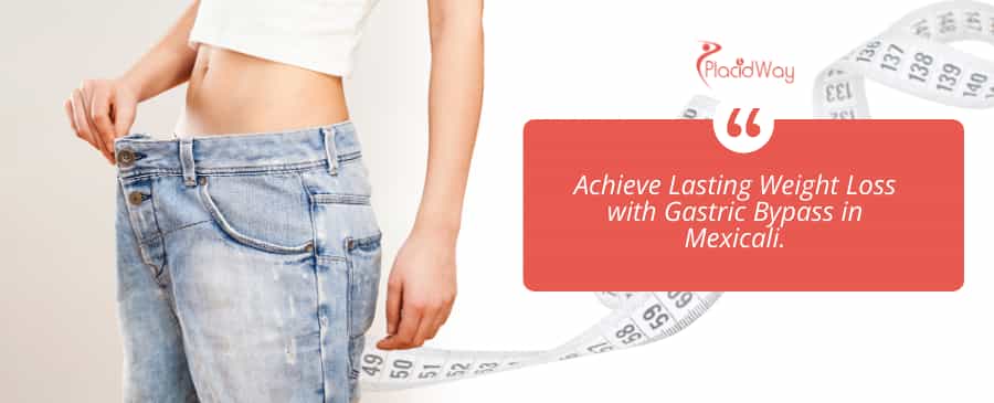 Gastric Bypass in Mexicali, Mexico thumbnail