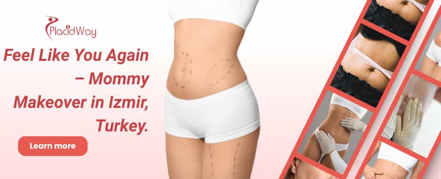 Mommy Makeover in Izmir, Turkey thumbnail