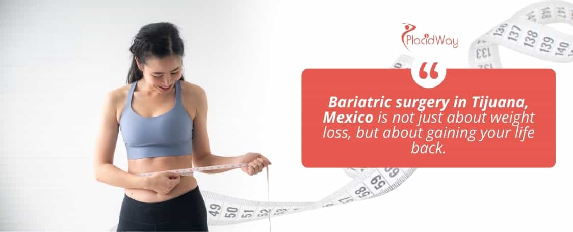 Cirugía Bariátrica en Tijuana, México thumbnail