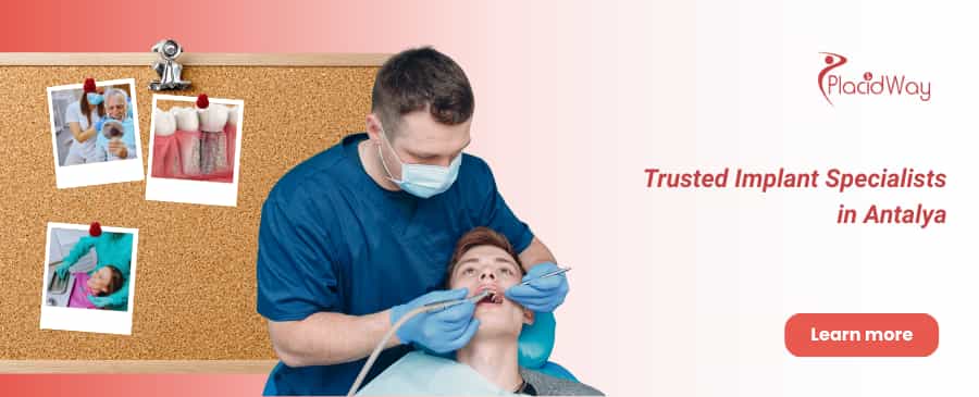 Implantes dentales All on 4 en Antalya thumbnail