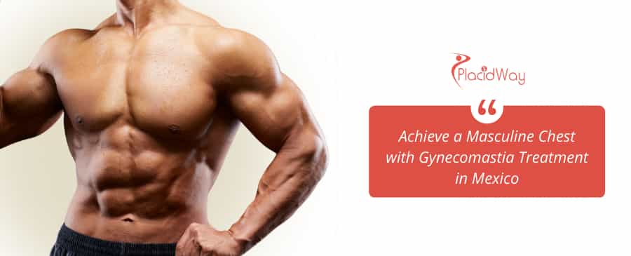 Gynecomastia in Mexico thumbnail